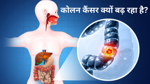 50 साल से कम उम्र में कोलन कैंसर क्यों बढ़ रहा है, जानें लाइफस्टाइल की कौन-सी गलती बन रही खतरा