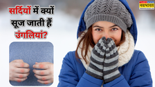 सर्दियों में क्यों सूज जाती हैं उंगलियां? यहां जान लें इस साधारण दिखने वाली समस्या के पीछे की असली वजह
