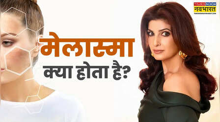 क्या होता है मेलास्मा, Twinkle Khanna ने किस ‘बिन बुलाए मेहमान’ का किया जिक्र, जानिए स्किन कंडीशन का सच