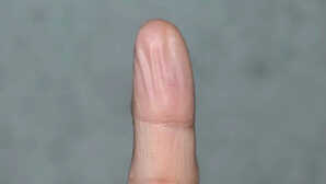 ज्यादा देर पानी में रहने पर क्यों सिकुड़ जाती हैं हमारी उंगलियां वजह जान लें आज