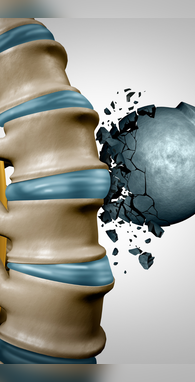 काजू-बादाम का बाप है ये सफेद ड्राई फ्रूट दूध के साथ खाने से हड्डियां बनेंगी फौलादी