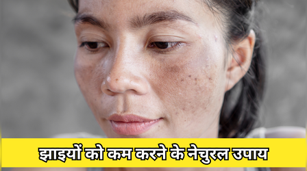 चेहरे के दाग धब्बे और पुरानी से पुरानी झाइयां होंगी दूर, आजमाएं ये 4 घरेलू उपाय