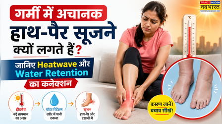 टाइम्स नाउ नवभारत एक्स्प्लेनर: गर्मी में अचानक हाथ-पैर सूजने क्यों लगते हैं, जानिए Heatwave और शरीर में पानी जमा होने का कनेक्शन