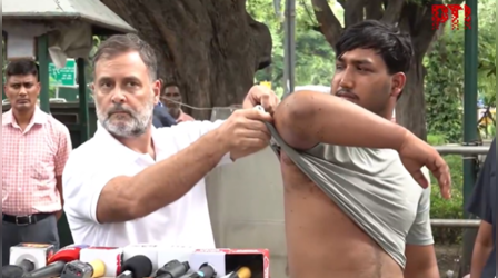 पैलेट गन से घायल छात्र के साथ मीडिया के सामने आए राहुल गांधी, दिखाए घाव; कहा- सच्चाई सामने