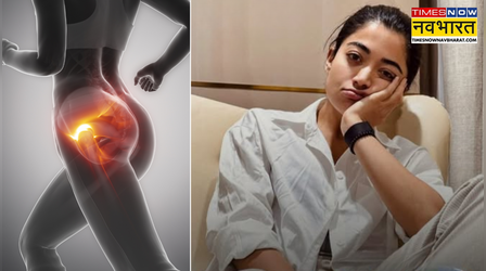 रश्मिका मंदाना को हुई Hip Injury, जानें बरतनी होगी क्या सावधानी, आप कैसे बचें