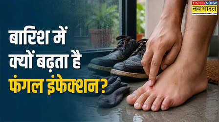 Monsoon Fungal Infection: बारिश में पैरों और त्वचा पर क्यों बढ़ जाता है फंगल इंफेक्शन, डॉक्टर ने बताए बचाव के तरीके