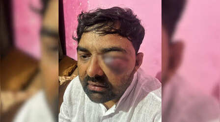 Meerut: किसान नेता से बर्बरता पर नए कप्तान का बड़ा एक्शन, दिग्विजय भाटी मामले में प्रभारी समेत 8 पुलिसकर्मी लाइन हाजिर